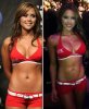Brittney-palmer-before-after-surgery.jpg Brittney-palmer-before-after-surgery.jpg